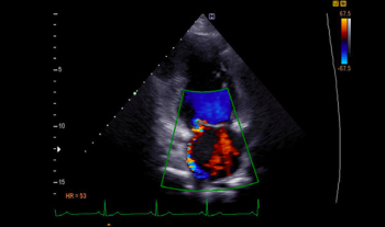 Các dấu hiệu và triệu chứng cần khám bằng siêu âm tim?
