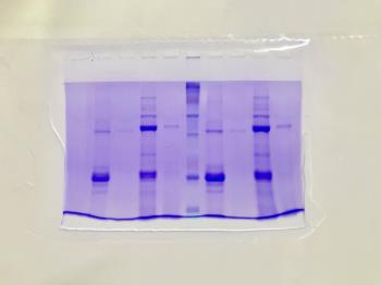 THỰC HÀNH KỸ THUẬT PHÂN TÍCH PROTEIN BẰNG WESTERN BLOT