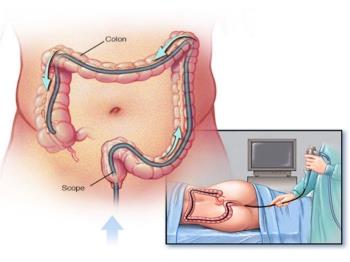 NỘI SOI ĐẠI TRÀNG VÀ NỘI SOI ĐIỀU TRỊ